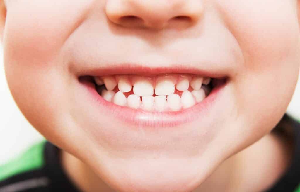 Close up of a little boy's smile