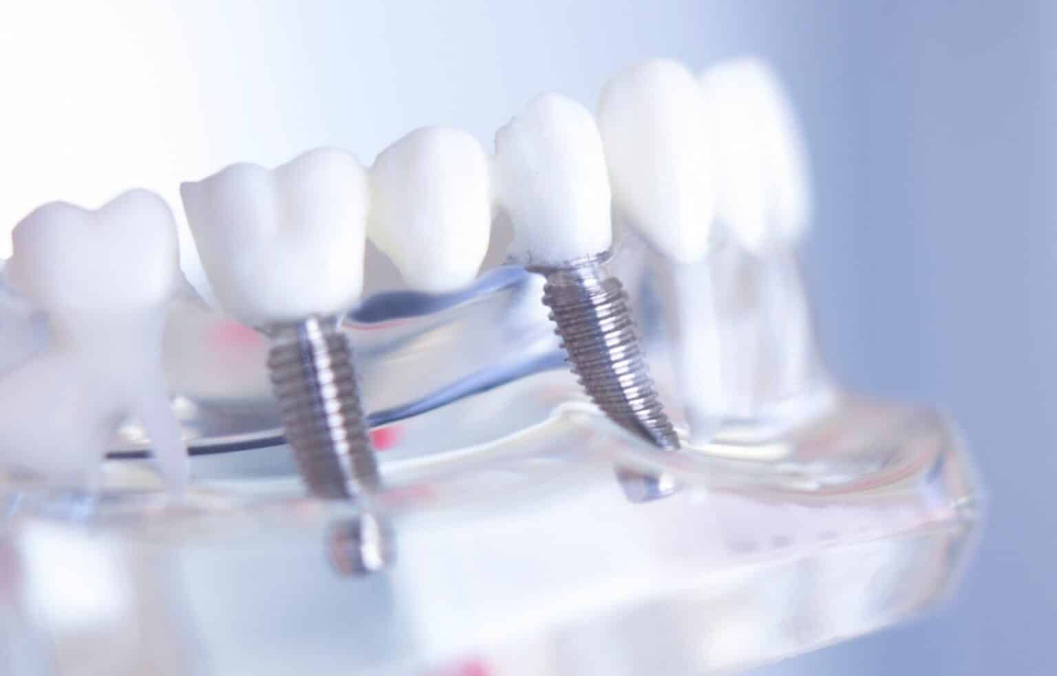 Oral Surgery | Georgia Dentist | Dental Town | Dental Town